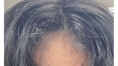 이런 곱슬머리 가진 사람 은근 있음.jpg