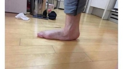 박지성도 평발이라는 소리가 지겨운 공익