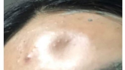 여친 딱밤 때렸는데 ㅈ댐